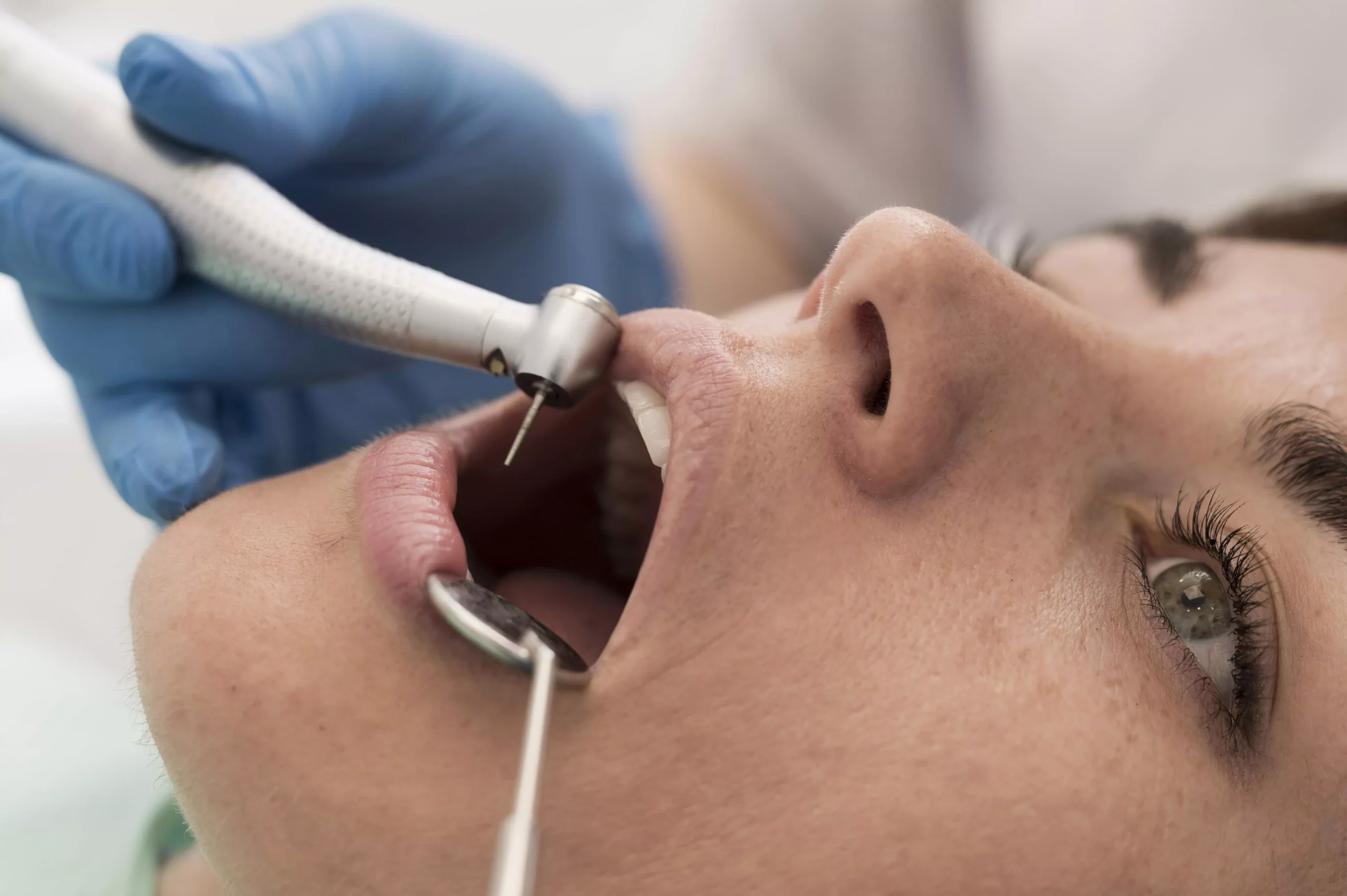 Prótesis removibles que se estabilizan sobre implantes dentales, proporcionando una solución cómoda, estable y funcional para pacientes con pérdida significativa de dientes.