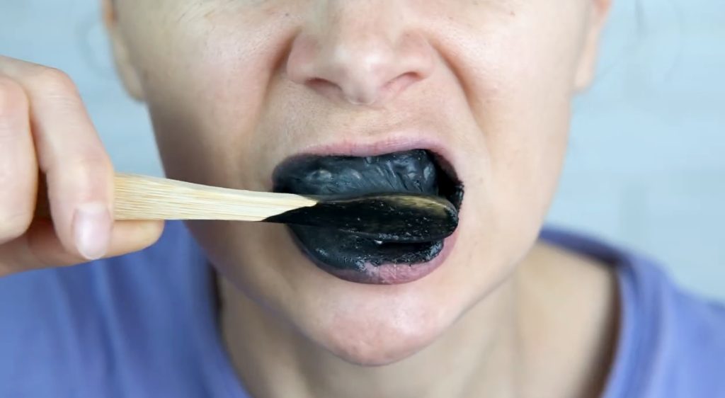blanqueamiento dental con carbon activo
