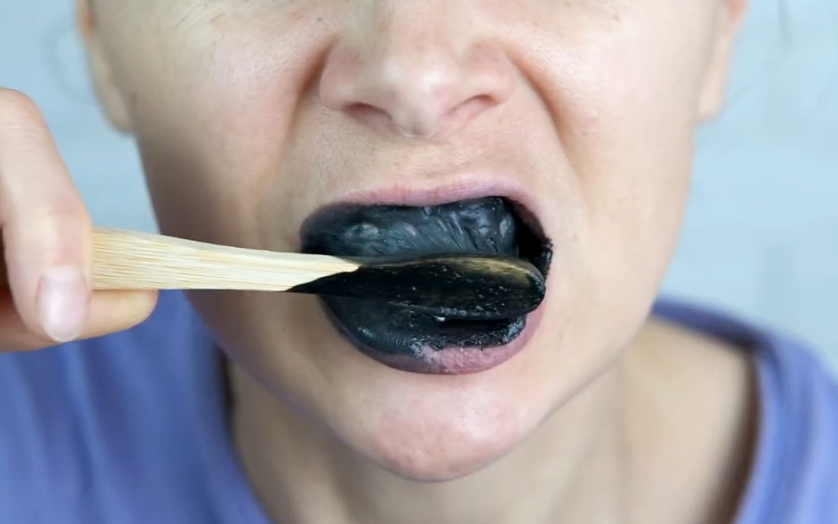 blanqueamiento dental con carbon activo