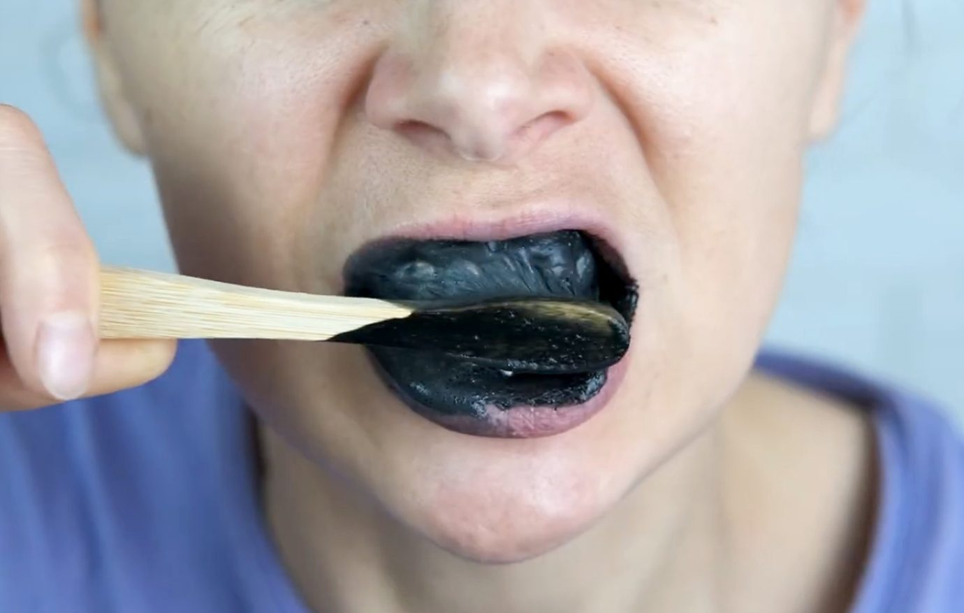 blanqueamiento dental con carbon activo