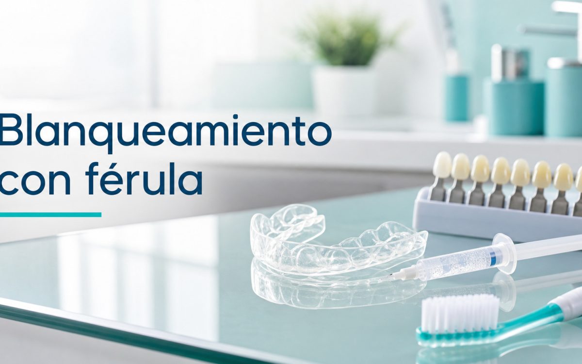 Cuidados durante un blanqueamiento dental con férula: guía para pacientes