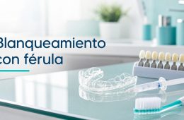 Cuidados durante un blanqueamiento dental con férula: guía para pacientes