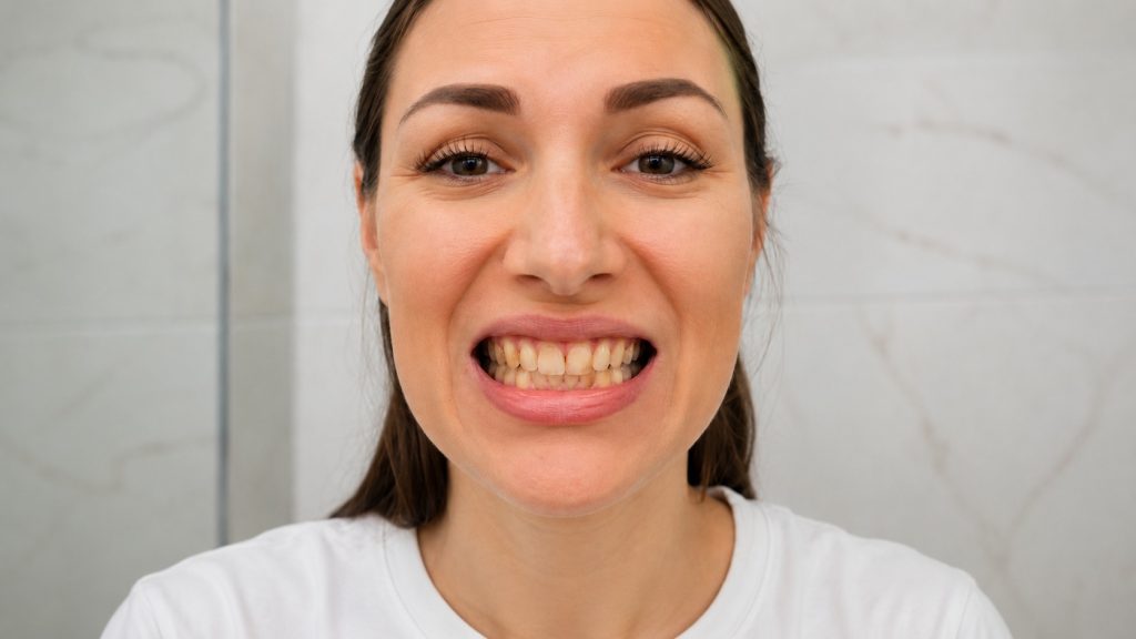 dientes amarillos