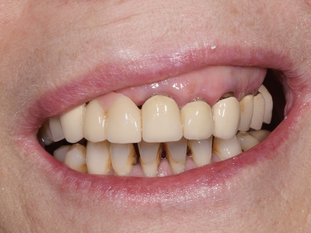 Tratamientos