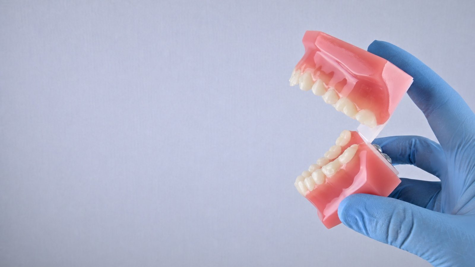 Mano con guante sosteniendo una dentadura para explicar un tratamiento dental