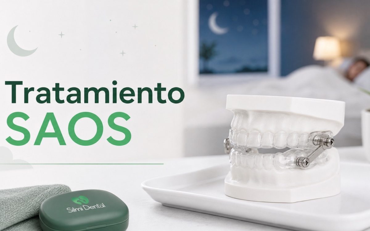 Tratamiento SAOS con dispositivo intraoral en Silmi Dental