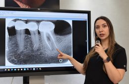 Retratamiento de endodoncia: cómo salvar una muela con pérdida de hueso
